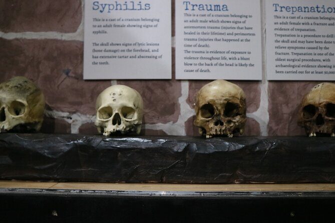 Admission Ticket to Sick To Death in Chester - Stop 1: Sick to Death and the Plague-Playground Story